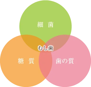 むし歯の原因