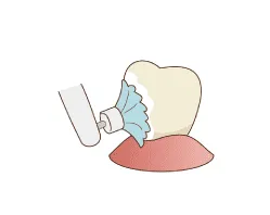 ブラシで歯の表面の着色などを クリーニングします。
