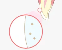 3.歯が白く美しく変身！